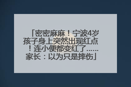 密密麻麻！宁波4岁孩子身上突然出现红点！连小便都变红了……家长：以为只是摔伤